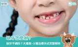 缺牙怎麼辦？缺牙不補的8大風險、5種治療方式完整解析