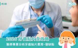 2026牙齒貼片全攻略：醫師專業分析牙齒貼片費用、優缺點，美白牙齒無煩惱！