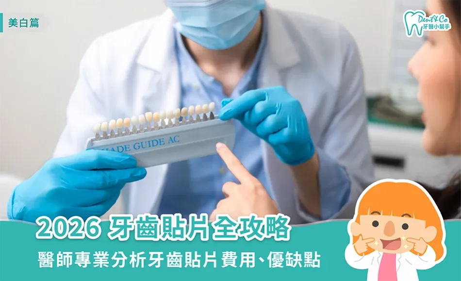 2026牙齒貼片全攻略：醫師專業分析牙齒貼片費用、優缺點，美白牙齒無煩惱！