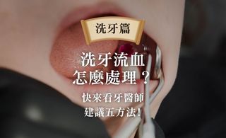 洗牙流血怎麼處理?牙醫師建議五方法!