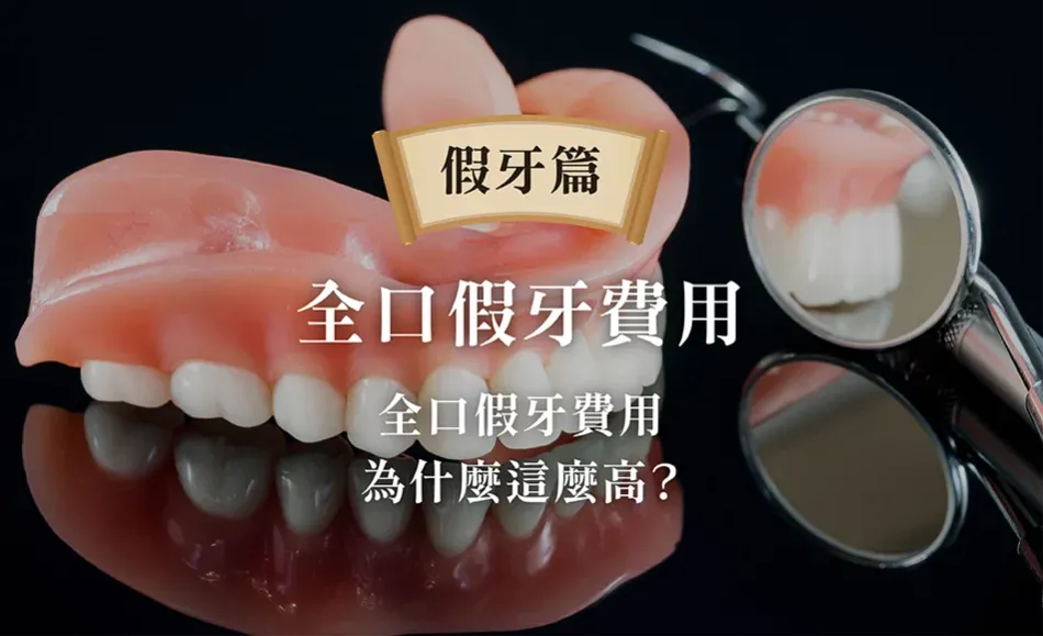 全口假牙費用介紹：了解活動式與固定式價格計算方式