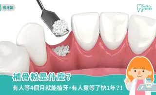補骨粉是什麼?多久可以植牙、後遺症與注意事項一次了解