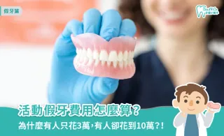 活動假牙費用怎麼算？價格差異、全口假牙費用與補助一次搞懂