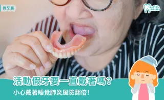 活動假牙要一直戴著嗎？專業醫師解析正確佩戴時間、清潔與適應技巧