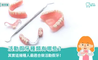 活動假牙種類有哪些?優缺點、適合族群與製作流程一次看