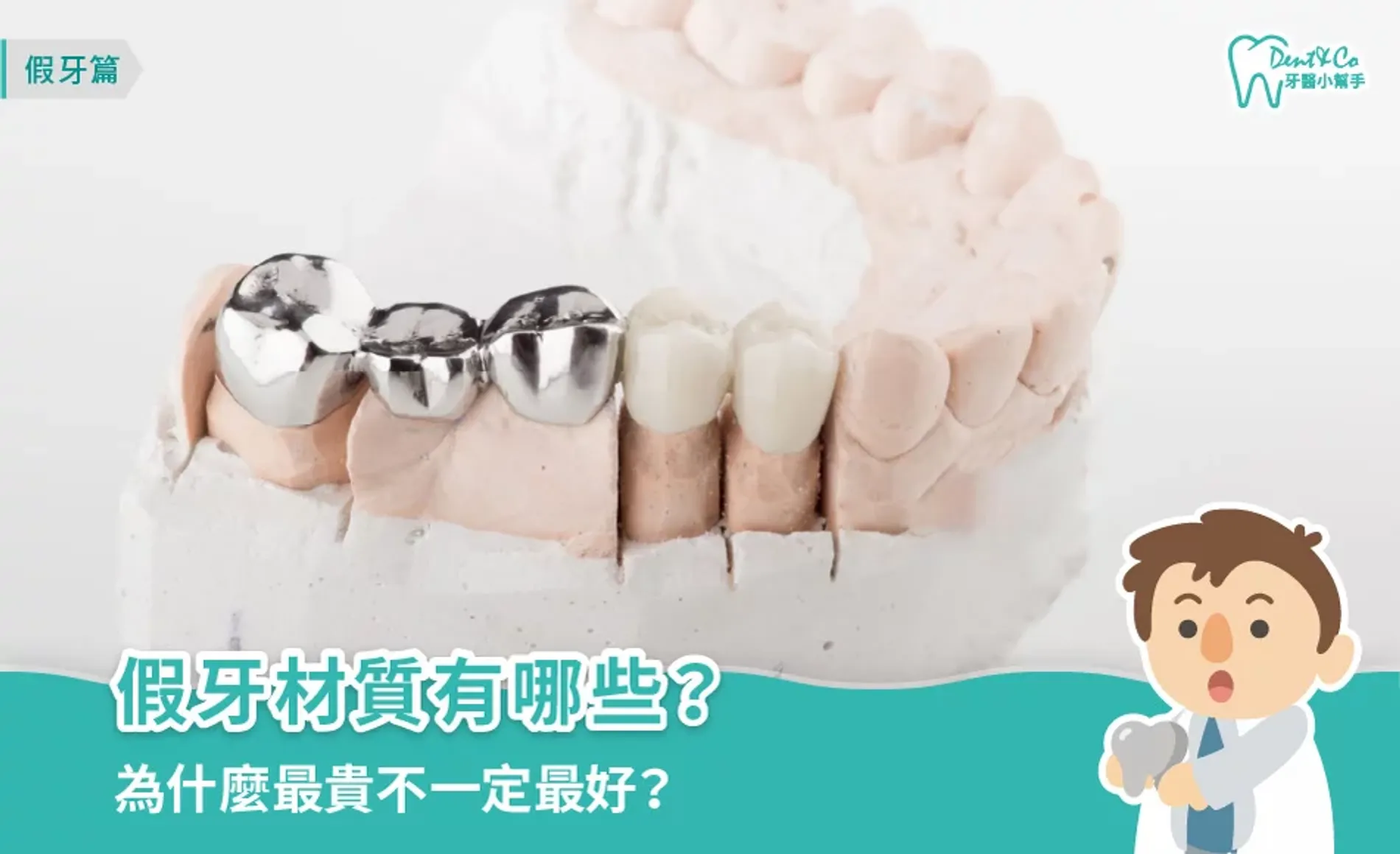 假牙材質有哪些？優缺點比較、挑選建議和保養方式全攻略