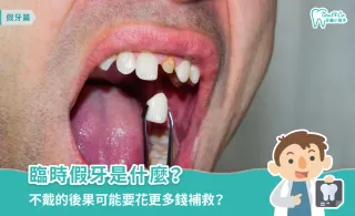 臨時假牙是什麼？必要性、配戴時間與居家護理全攻略