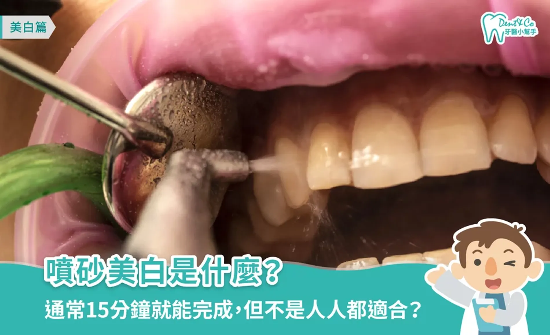 噴砂美白是什麼？費用、療程、時間、優缺點全介紹
