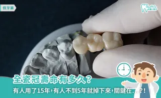 全瓷冠壽命有多久？注意事項與保養秘訣一次看懂