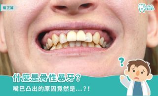 深入解析骨性暴牙:從判斷到矯正,一次掌握