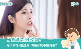 牙齒黃怎麼改善?成因、5大治療方法、保養要點一次看!