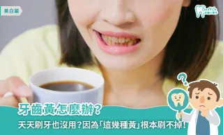 牙齒黃怎麼辦？專業解析5大變黃原因，教你如何讓牙齒變白！