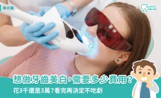 牙齒美白費用與療程總整理：效果、價格、保養全解析