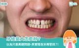牙縫變大怎麼辦？專業牙醫解析常見原因、蛀牙風險與補牙費用