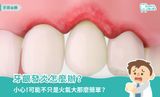 牙齦發炎怎麼辦？牙齦腫脹原因、症狀、緩解及預防方式一次看！