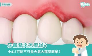 牙齦發炎怎麼辦?牙齦腫脹原因、症狀、緩解及預防方式一次看!