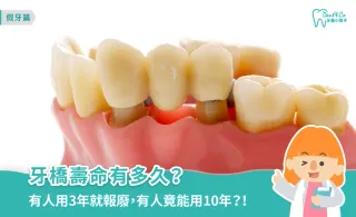 牙橋壽命有多久？專業醫師解析影響年限原因與清潔保養方法