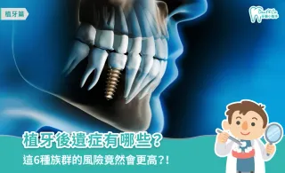 植牙後遺症有哪些？高風險族群、預防方法全攻略