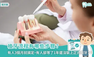 植牙流程全攻略：專業解析手術步驟、影響時間的因素與副作用