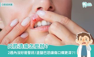 口腔潰瘍怎麼辦?成因、5大種類、快速復原和預防方法全攻略
