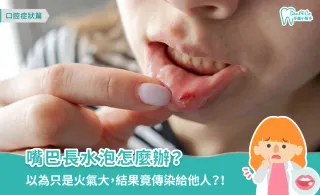嘴巴長水泡怎麼辦？3大原因、注意事項、預防方式一次看