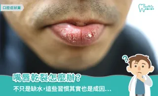 嘴唇乾裂怎麼辦?成因、保養方法、如何預防以及常見迷思一次看