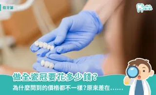 全瓷冠多少錢?一篇秒懂價格行情、材質差異與費用4大關鍵