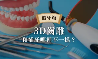 3D齒雕是什麼?3D齒雕優缺點、後遺症、預防失敗指南,一次了解|蛀牙補牙必知
