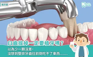 臼齒拔掉一定要植牙嗎?缺牙風險、傷口照護一次看