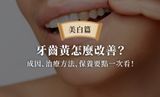 牙齒黃怎麼改善？成因、5大治療方法、保養要點一次看！