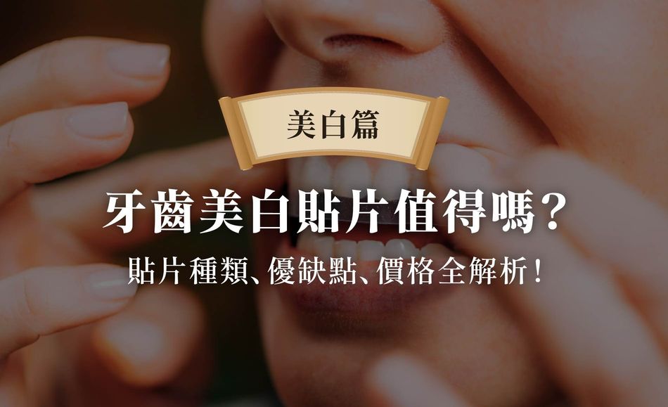 牙齒美白貼片值得嗎？貼片種類、優缺點、價格全解析！