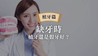 缺牙做假牙還是植牙好?教你如何比較假牙與植牙的CP值,不錯過最佳的治療方法!